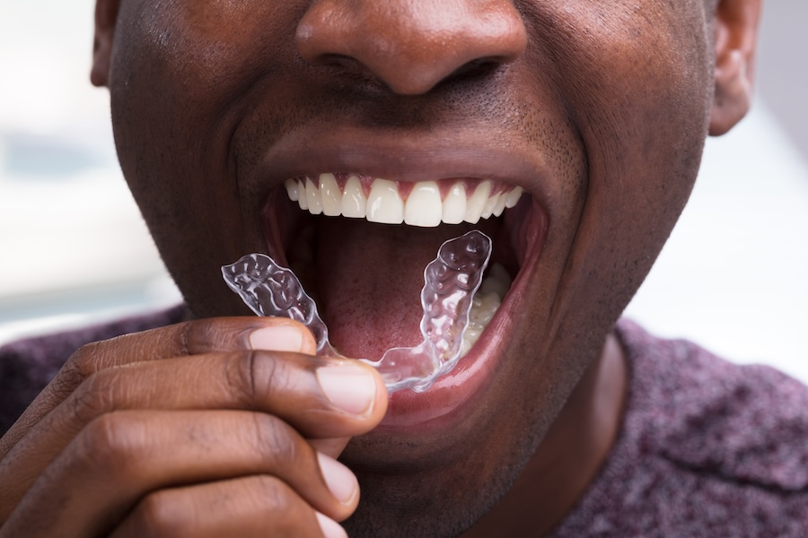 Invisalign care, Invisalign tips, dental aligners, Invisalign maintenance, oral health with Invisalign, Dr. Laura Ward, Middletown Commons Family Dental, Louisville Invisalign, dentist in Louisville